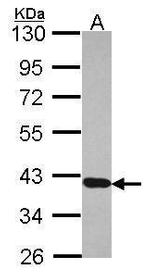 RDH5 Antibody in Western Blot (WB)