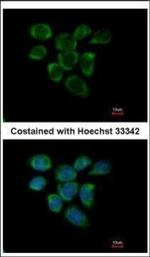 RPL7A Polyclonal Antibody