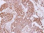 RPL7A Antibody in Immunohistochemistry (Paraffin) (IHC (P))