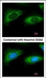 RPL9 Polyclonal Antibody