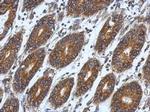 RPL9 Antibody in Immunohistochemistry (Paraffin) (IHC (P))