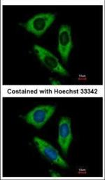 RPL24 Polyclonal Antibody