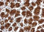 RPLP0 Polyclonal Antibody
