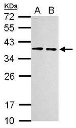 RPLP0 Antibody in Western Blot (WB)