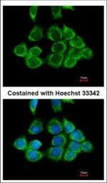 RPS2 Polyclonal Antibody
