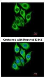 SERPINB3 Polyclonal Antibody