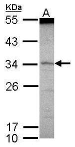 SCML1 Polyclonal Antibody