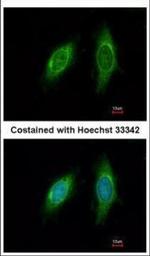 SGTA Polyclonal Antibody