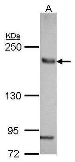 SLC4A2 Polyclonal Antibody