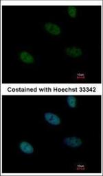 HLTF Polyclonal Antibody
