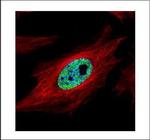 SMARCC1 Antibody in Immunocytochemistry (ICC/IF)