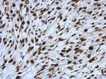 SMARCC1 Antibody in Immunohistochemistry (Paraffin) (IHC (P))