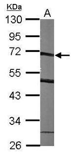 SMARCD1 Antibody in Western Blot (WB)