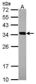SULT2A1 Polyclonal Antibody