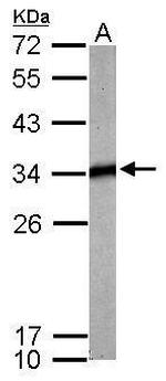 TPM4 Antibody in Western Blot (WB)