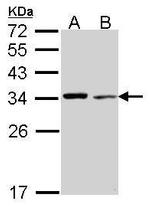 TPM4 Antibody in Western Blot (WB)