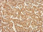 TST Polyclonal Antibody