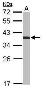 TST Antibody in Western Blot (WB)