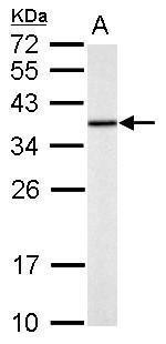 TST Antibody in Western Blot (WB)