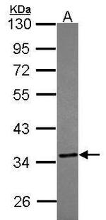 TST Antibody in Western Blot (WB)