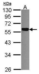 DNAJC7 Antibody in Western Blot (WB)