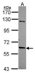 TULP2 Polyclonal Antibody