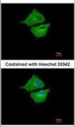 UBE2G1 Polyclonal Antibody