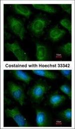 UBE2L3 Polyclonal Antibody