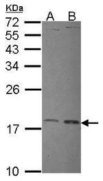 UBE2L3 Antibody in Western Blot (WB)