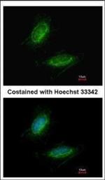 UMPS Polyclonal Antibody