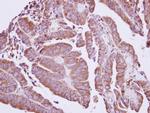 Coronin 2A Antibody in Immunohistochemistry (Paraffin) (IHC (P))