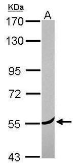 Coronin 2A Antibody in Western Blot (WB)