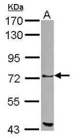 ZKSCAN1 Antibody in Western Blot (WB)