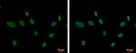 ZNF74 Polyclonal Antibody