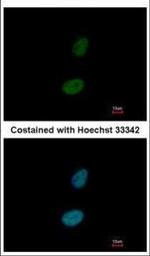 ZNF133 Polyclonal Antibody