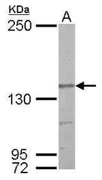 Nardilysin Polyclonal Antibody