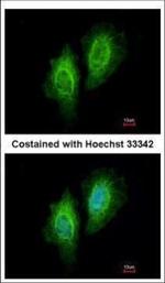 eIF4A1 Antibody in Immunocytochemistry (ICC/IF)