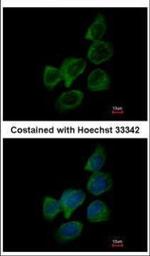 Aldolase B Polyclonal Antibody