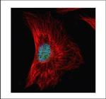 SRSF1 Polyclonal Antibody