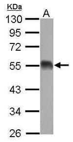 eIF5 Antibody in Western Blot (WB)