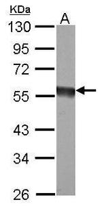 eIF5 Antibody in Western Blot (WB)