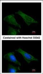 TIMP4 Polyclonal Antibody