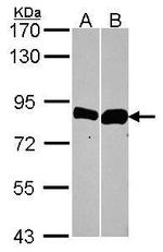 Thimet Oligopeptidase Antibody in Western Blot (WB)