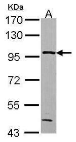 GPBB Antibody in Western Blot (WB)