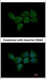 CALML3 Polyclonal Antibody