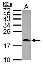 CALML3 Antibody in Western Blot (WB)