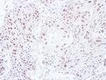 ELK3 Antibody in Immunohistochemistry (Paraffin) (IHC (P))