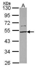SMARCD1 Antibody in Western Blot (WB)
