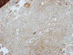 LIMS1 Polyclonal Antibody