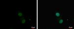 PKNOX1 Polyclonal Antibody
